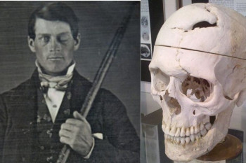 O curioso caso de Phineas Gage